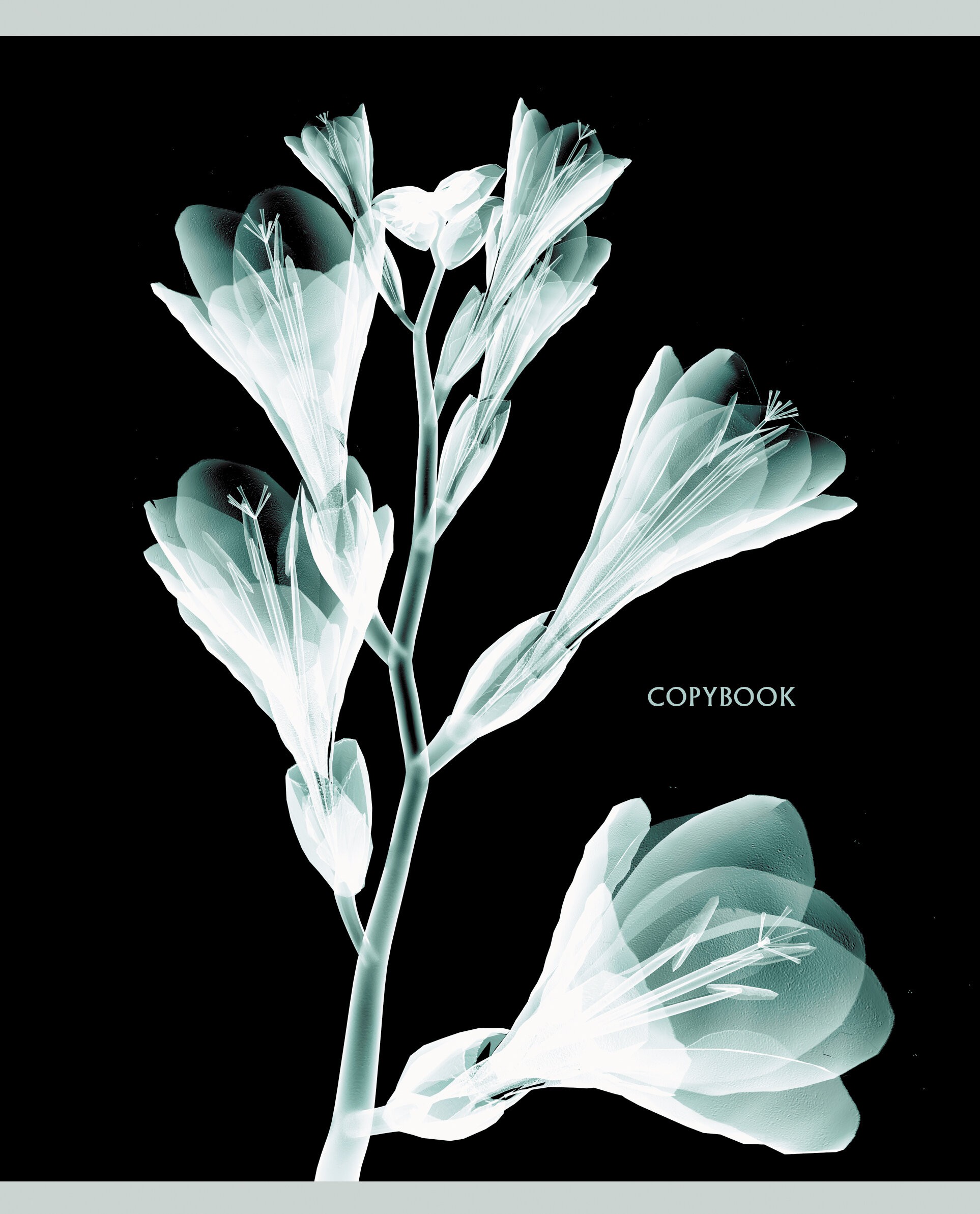 X-ray – ТКФЛ487911 X-ray – ТКФЛ487911