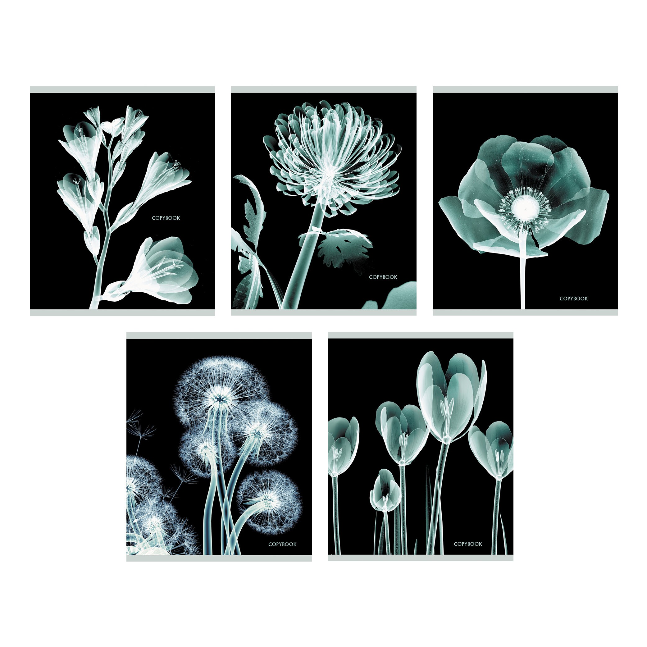 X-ray – ТКФЛ487911 X-ray – ТКФЛ487911